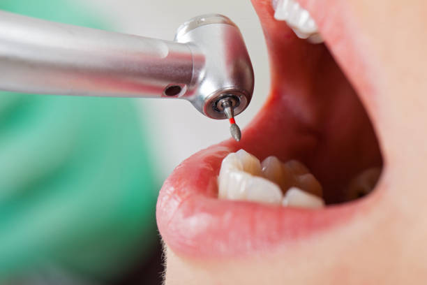 Best Weekend Emergency Dentist in Cheree, OK